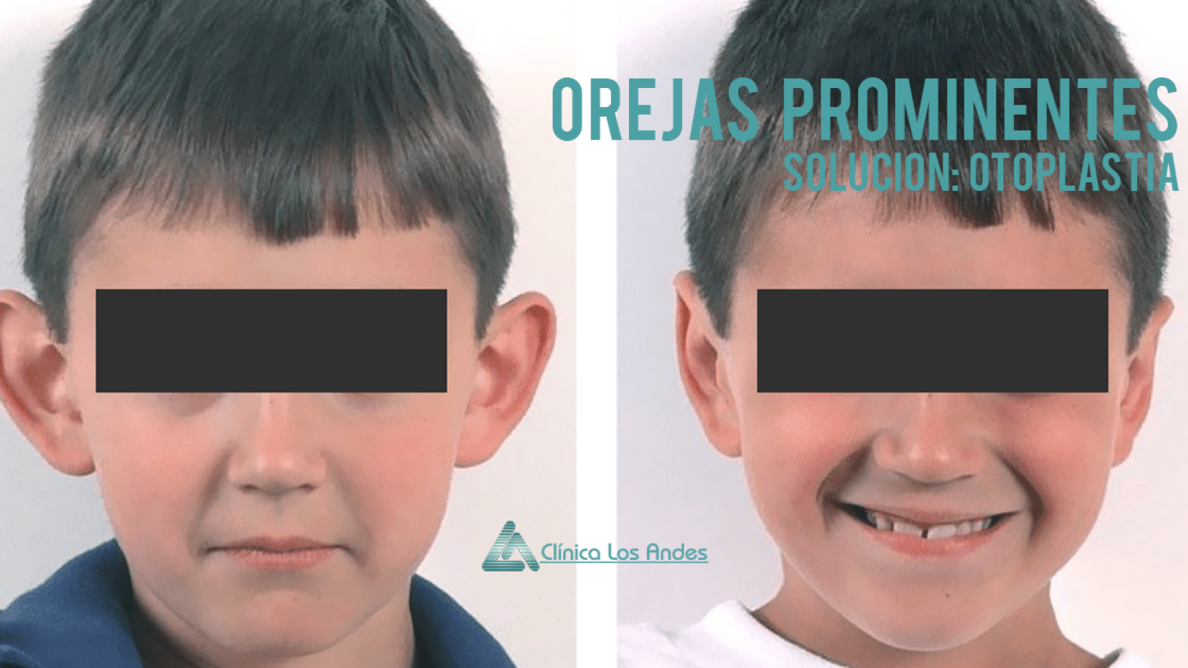 orejas de soplillo