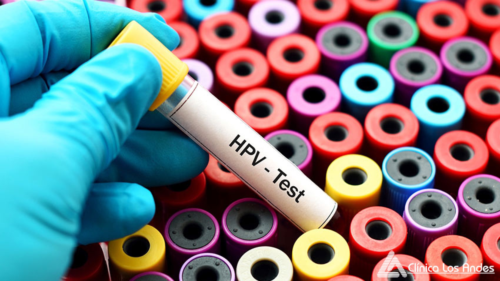 Blood for HPV test