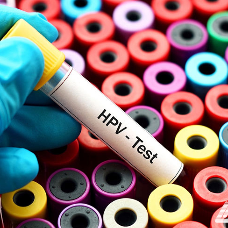 Blood for HPV test